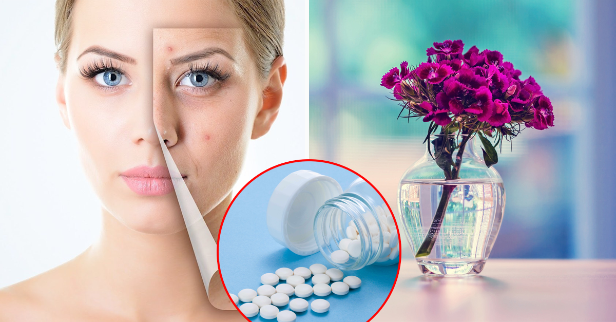 5 Home Remedies to Get Rid of Acne Overnight -2- 24beautytutorial.com